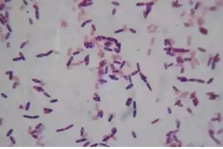 1606294615.jpg 1606294615.jpg